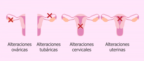 TP - Infertilidad y dificultad para concebir. Causas y tratamientos ...