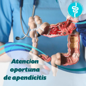La apendicitis es una inflamación o hinchazón del apéndice .  - Gastroenterólogo - Dr. Daniel Oloarte